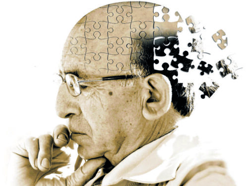 I primi segni di Alzheimer che tutti gli adulti dovrebbero conoscere
